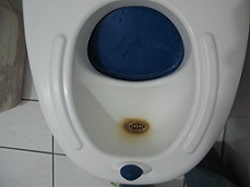 toilet-stain